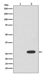 Anti-RFP rfp1 Rabbit Monoclonal Antibody Boster Bio