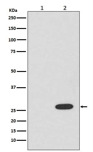 Anti-RFP rfp1 Rabbit Monoclonal Antibody Boster Bio