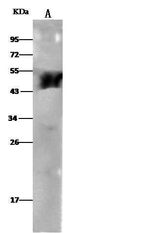 Anti-Human ALDH3A1 Antibody [A1274] - ABMIUM