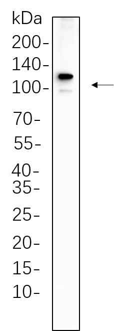 Anti-Human PMS2 Antibody [B1146] - ABMIUM