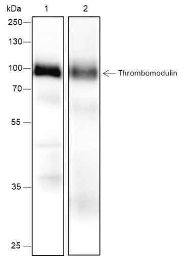 Anti-Human Thrombomodulin Antibody [A448] - ABMIUM