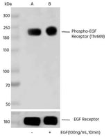 Anti-Human EGFR Antibody [A1121]