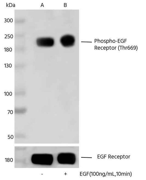 Anti-Human EGFR Antibody [A1121] - ABMIUM