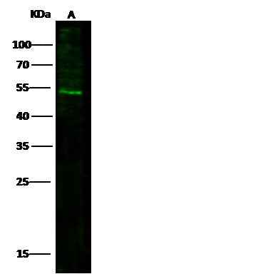 Anti-Human IFNGR1 Antibody [A1144] - ABMIUM