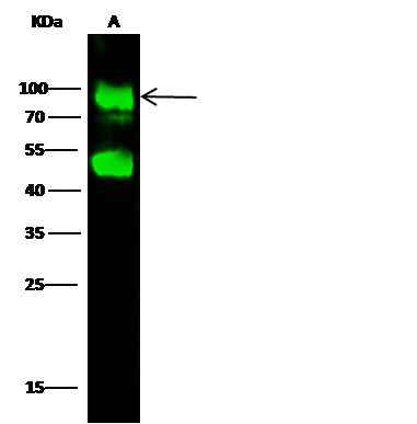 Anti-Human GNS Antibody [B101] - ABMIUM