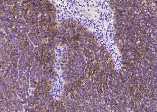 Anti-Human MSLN Antibody [A982] - ABMIUM