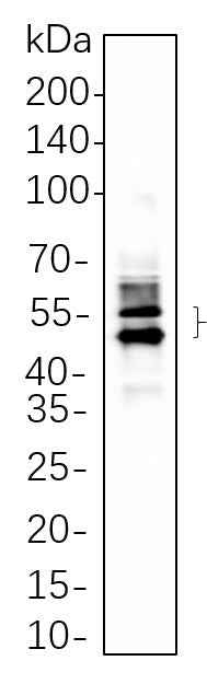 Anti-Human/Mouse/Rat MAPKAPK-2 Antibody [B583] - ABMIUM