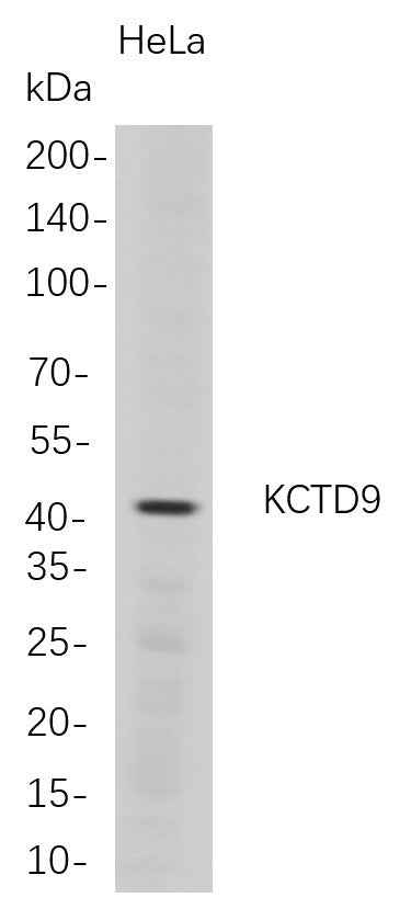 Anti-Human KCTD9 Antibody [B703] - ABMIUM