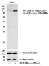 Anti-Human IGF1R Antibody [A1161] - ABMIUM