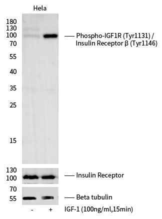 Anti-Human IGF1R Antibody [A1161] - ABMIUM