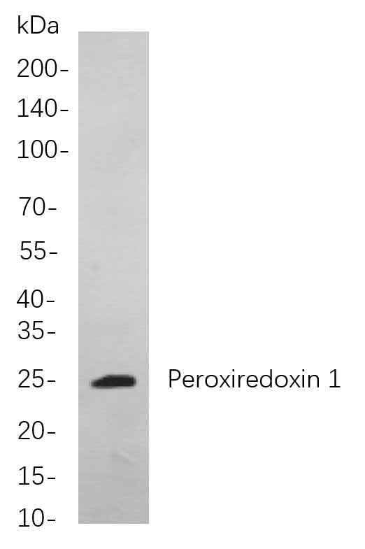 Anti-Human/Mouse/Rat Peroxiredoxin 1 Antibody [B718] - ABMIUM