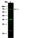 Anti-Human GOLM1 Antibody [A1074] - ABMIUM