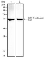 Anti-Human/Rat/Mouse DOPA Decarboxylase/DDC Antibody [A413]