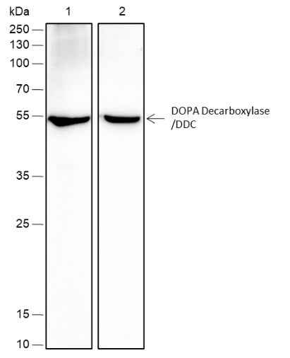 Anti-Human/Rat/Mouse DOPA Decarboxylase/DDC Antibody [A413] - ABMIUM