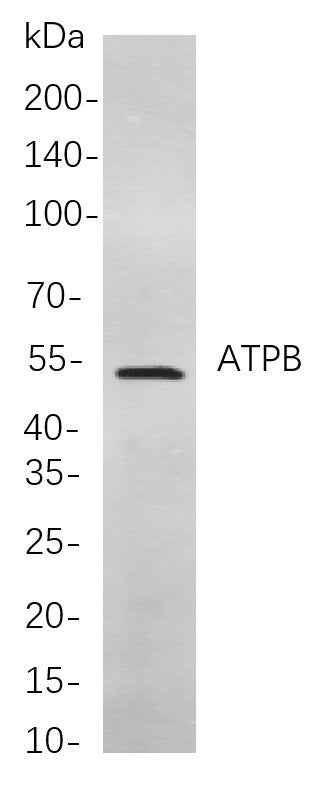 Anti-Human/Mouse/Rat ATPB Antibody [B716] - ABMIUM