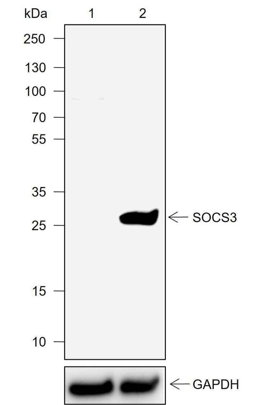 Anti-Mouse SOCS3 Antibody [A723] - ABMIUM