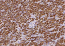 Anti-Human CPA1 Antibody [A954] - ABMIUM