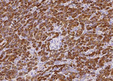 Anti-Human CPA1 Antibody [A954] - ABMIUM