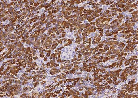 Anti-Human CPA1 Antibody [A954] - ABMIUM