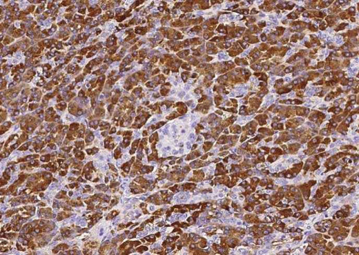 Anti-Human CPA1 Antibody [A954] - ABMIUM