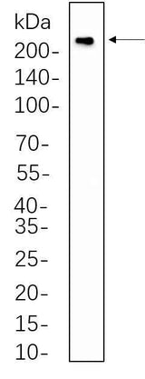 Anti-Human/Mouse/Rat VEGF Receptor 2 Antibody [B1082]