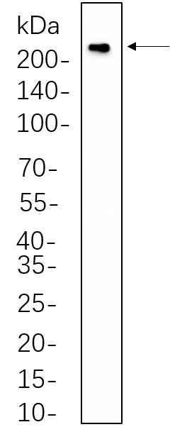 Anti-Human/Mouse/Rat VEGF Receptor 2 Antibody [B1082] - ABMIUM