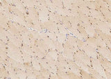 Anti-Human BMI1 Antibody [A1255] - ABMIUM