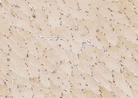 Anti-Human BMI1 Antibody [A1255] - ABMIUM