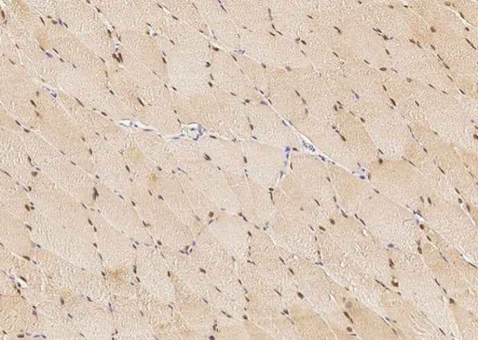 Anti-Human BMI1 Antibody [A1255] - ABMIUM