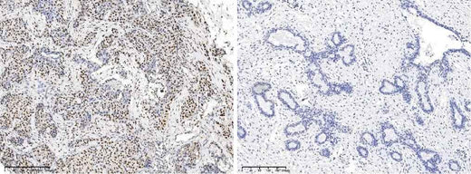 Anti-Human CREB1 Antibody [A1237] - ABMIUM