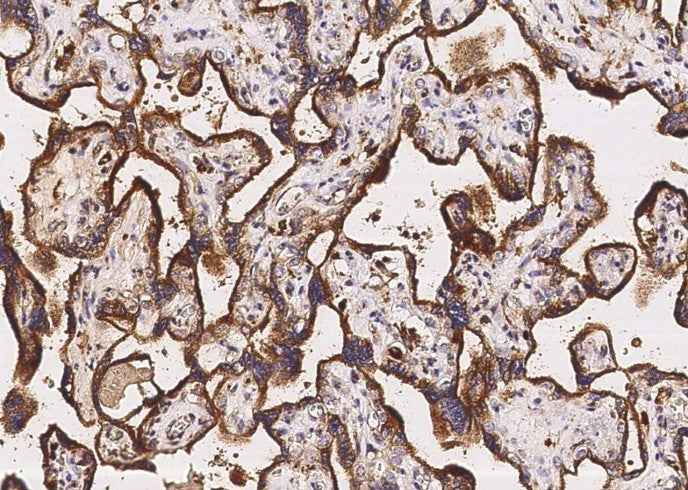 Anti-Human LAMP2 Antibody [A1083] - ABMIUM