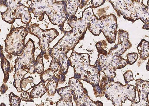 Anti-Human LAMP2 Antibody [A1083] - ABMIUM
