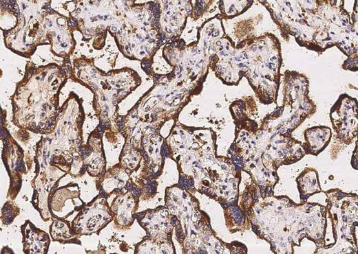 Anti-Human LAMP2 Antibody [A1083] - ABMIUM