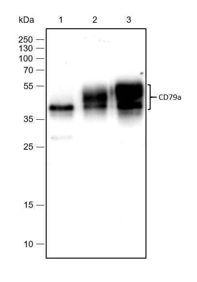 Anti-Human CD79a Antibody [A181] - ABMIUM
