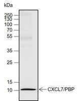 Anti-Human CXCL7/PBP Antibody [A712]