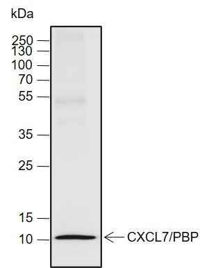 Anti-Human CXCL7/PBP Antibody [A712] - ABMIUM