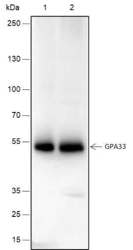 Anti-Human GPA33 Antibody [A238] - ABMIUM