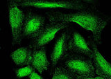 Anti-Human ASF1B Antibody [A1094] - ABMIUM