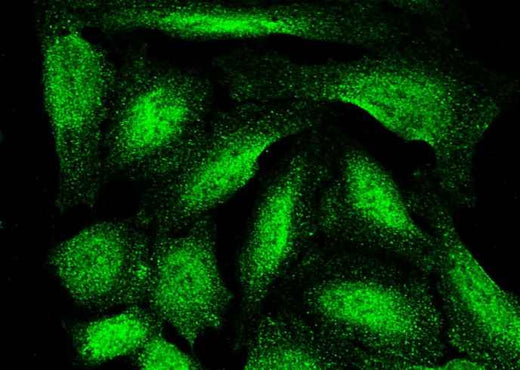 Anti-Human ASF1B Antibody [A1094] - ABMIUM
