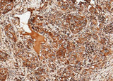 Anti-Human ULBP2 Antibody [A1251] - ABMIUM