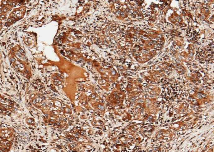 Anti-Human ULBP2 Antibody [A1251] - ABMIUM