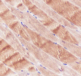 Anti-Human/Rat/Mouse Ryanodine Receptor Antibody [A703]