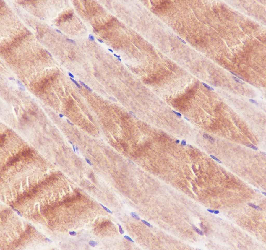 Anti-Human/Rat/Mouse Ryanodine Receptor Antibody [A703]