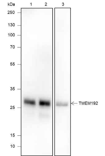 Anti-Human/Rat TMEM192 Antibody [A603]