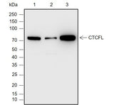 Anti-Human/Rat/Mouse CTCFL Antibody [A781] - ABMIUM