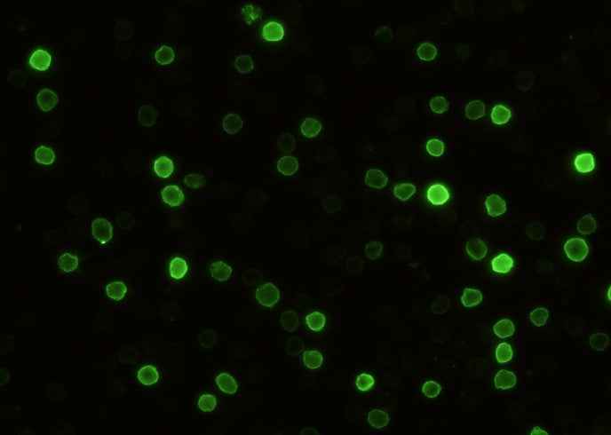 Anti-Mouse CD5 Antibody [B444] - ABMIUM