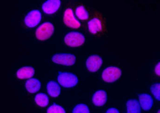 Anti-Human SUB1 Antibody [A993] - ABMIUM