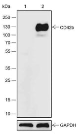 Anti-Human CD42b Antibody [A557]