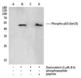 Anti-Human TP53 Antibody [B289]