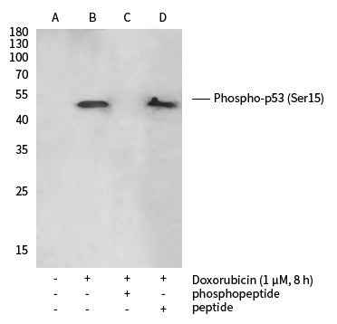 Anti-Human TP53 Antibody [B289] - ABMIUM